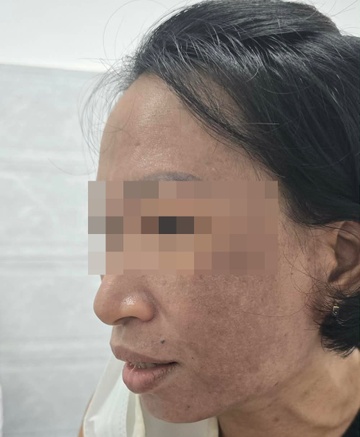 Mỹ phẩm đội lốt cao cấp kiểu Mailisa: Bác sĩ nêu điều nguy hiểm nhất