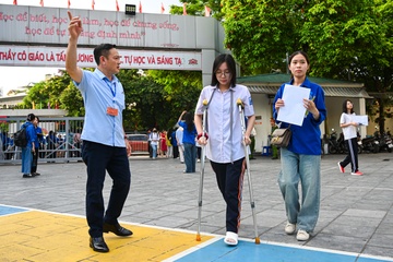 Gay chan truoc ngay vuot vu mon, si tu nen dau chong nang di thi hinh anh