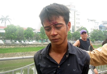 Bat ke cuop iPhone 5 cua nu sinh ngan hang hinh anh