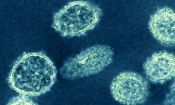 Chuyen gia canh bao nguy co dai dich do chung moi virus H1N1 o TQ hinh anh