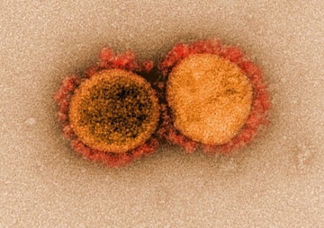 'Kich ban ac mong' tu bien chung virus moi phat hien o California hinh anh