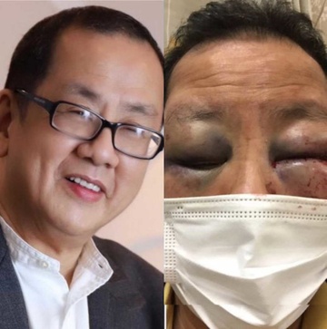 Nguoi goc A muon roi San Francisco sau khi bi hanh hung den bat tinh hinh anh