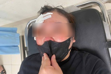 Nu tai xe o Ha Noi 'to' bi nguoi di oto dung dui cui vut vao dau hinh anh