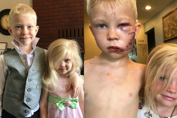 Dien mao bat ngo cua cau be tung bi khau 90 mui vi cuu em khoi cho du hinh anh