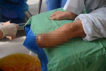 Can benh dang am tham de doa tinh mang hon 400 trieu nguoi hinh anh