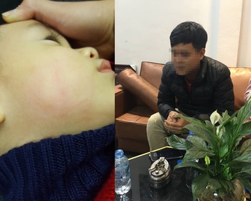 Be trai 22 thang tuoi bi bac si tat do mat tai phong kham hinh anh