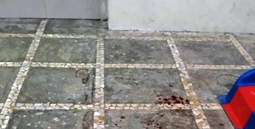 Be 3 tuoi bi da roi trung dau tu vong khi choi duoi san chung cu hinh anh