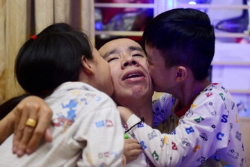 Cap song sinh dinh lien Viet - Duc sau 28 nam mo tach roi hinh anh