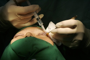 Cac co gai khoe tiem filler nhu the trung tui hieu hinh anh