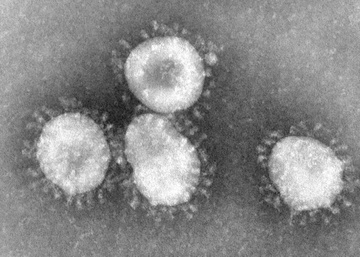 Benh nhan o Da Nang mang chung virus chua tung xuat hien tai Viet Nam hinh anh