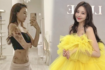 Hot girl Han bang hoang khi ca co the bam tim sau 2 gio gay me lam dep hinh anh