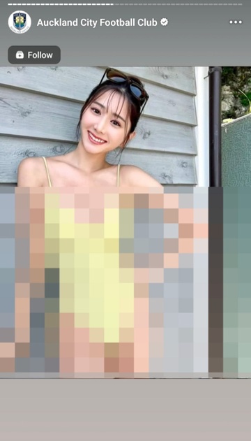 Auckland bi hack anh 1