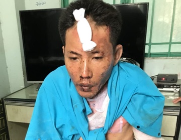 Bi duoi khoi phong tro, nguoi dan ong dot vo va 2 con gai hinh anh