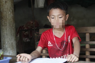 Khong lam duoc bai, nam sinh lop 4 bi thay danh nhap vien hinh anh