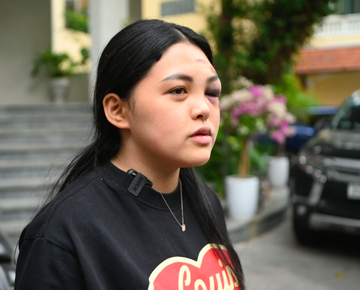 Xet xu 'nu quai' dua xe, tong tu vong co gai dung cho den do o Ha Noi hinh anh