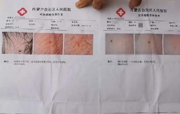 Ba giao vien Trung Quoc bi bat vi dam kim vao nguoi hoc sinh hinh anh