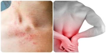 Những triệu chứng suy thận nhẹ bạn cần biết