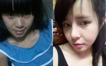 Co gai sut moi 'vit hoa thien nga' nho dao keo hinh anh