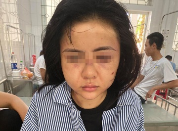 Hoi Phu nu len tieng, cam ket bao ve co gai bi hanh hung gan 2 gio hinh anh