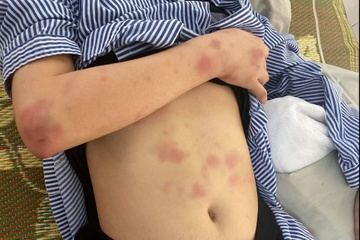 Trieu tap nguoi hanh hung co gai suot 2 gio hinh anh