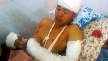 Bat nam thanh nien co lenh truy na sau tiec cuoi hinh anh