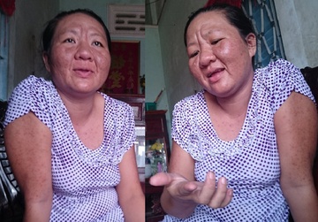 Dung thuoc di ung, ba bau 'bien thanh' ba lao U60 hinh anh