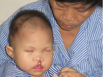 Hanh trinh tim lai nu cuoi cua em be 2 tuoi bi bo roi hinh anh