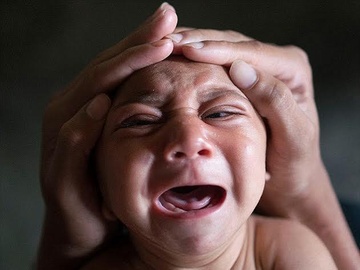 6 dieu can biet ve virus Zika hinh anh