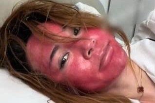 Soc voi khuon mat cua nguoi phu nu Trung Quoc 22 nam khong tay trang hinh anh