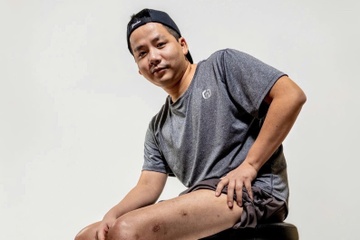 Khoa Pug keo chan 2 lan de cao 1m80, chuyen gia noi gi? hinh anh