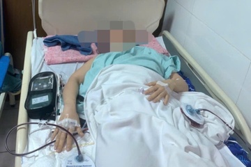 Công ty sự kiện lên tiếng vụ cô gái bị đèn đám cưới rơi thương tật 96%