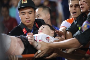 Phao sang va moi hoa can loai bo khoi bong da Viet Nam hinh anh