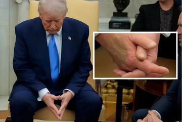 Bàn tay của ông Trump bất ngờ thu hút sự chú ý