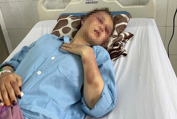 Can cu khoi to nguoi dan ong danh ban gai vi ghen o quan karaoke hinh anh