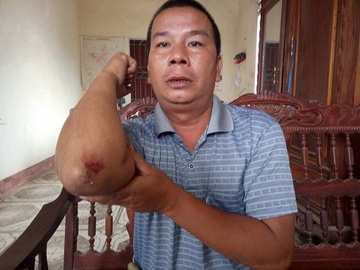 Ngan khai thac cat trai phep, truong cong an xa bi hanh hung hinh anh