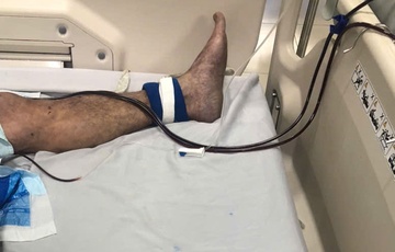 Tiep xuc loai thuc pham quen thuoc, nguoi dan ong nguy kich hinh anh