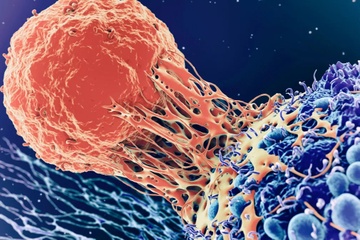 5 loai ung thu dan ong Viet mac nhieu nhat hinh anh