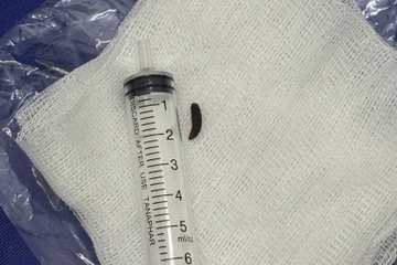 Gioi ngo ngoe trong tai benh nhi khien bac si soc hinh anh