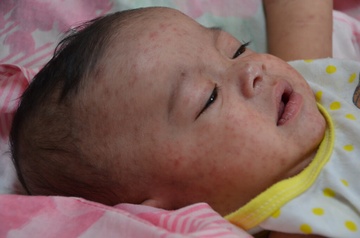 Nguy co sot xuat huyet o TP.HCM khi mua mua den hinh anh