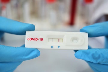 Bo Y te: Doanh nghiep tu cong bo gia cac loai test nhanh hinh anh