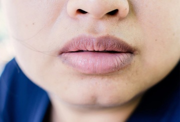 Dấu hiệu phổi chứa nhiều độc tố biểu hiện ngay trên mặt