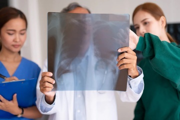 4 lam tuong pho bien ve COPD hinh anh