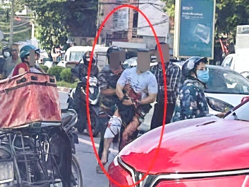 Điều tra vụ một Tiktoker nổi tiếng bị chém đứt bàn tay giữa đường