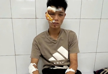 Lời khai của quái xế đi vào đường cấm phục vụ A80, tông cảnh sát
