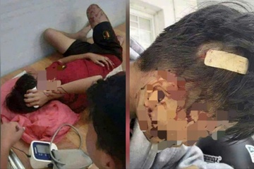 Học sinh lớp 8 bị bạn dùng gậy đánh nhập viện