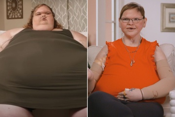 Noi so sau khi giam hon 200 kg hinh anh