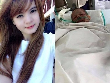 Co gai bi ban trai tuoi xang thieu song qua doi hinh anh