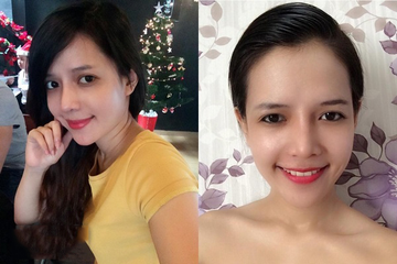 Minh Yến đẹp rạng rỡ và tự tin sau phẫu thuật.