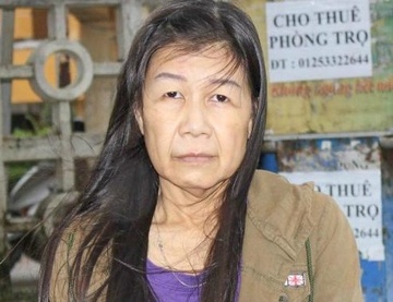 Co gai 22 tuoi mang guong mat ba lao 80 duoc phau thuat mien phi hinh anh