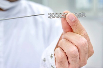 Dat stent mach vanh khong lo doi chi phi hinh anh